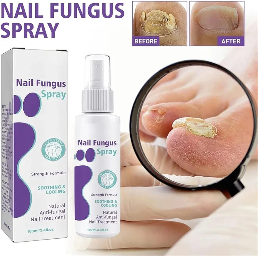 Nails fungus spray.
