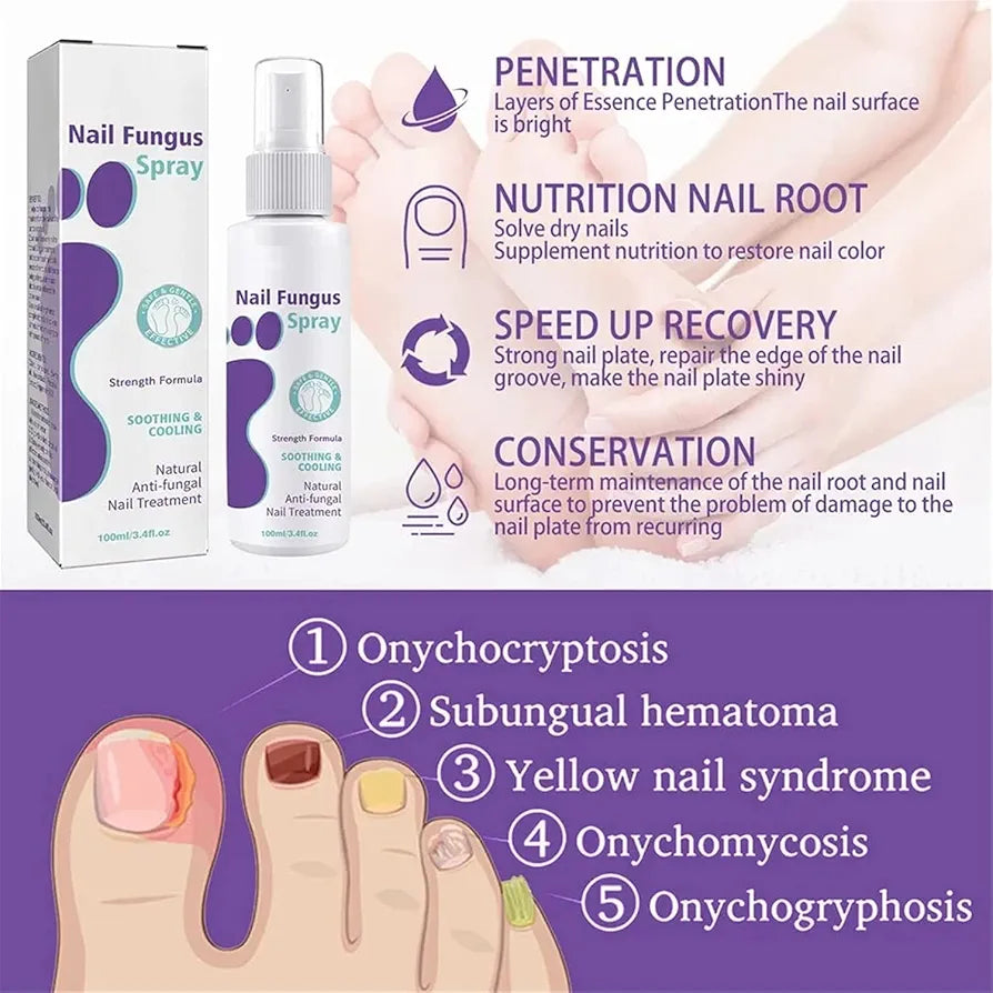 Nails fungus spray.