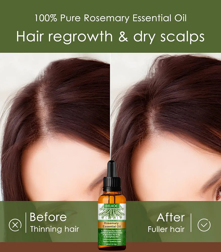 Hair growth oil rosemary essential oil (30ml)