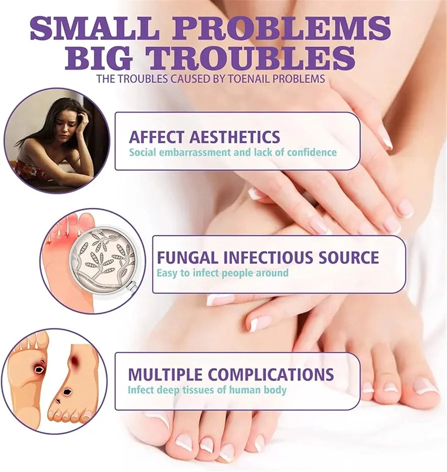 Nails fungus spray.