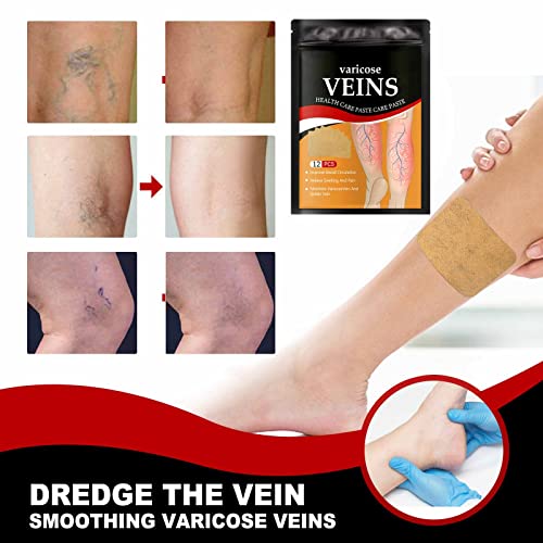 Varicose Veins Health Care Patch – 12 Pcs