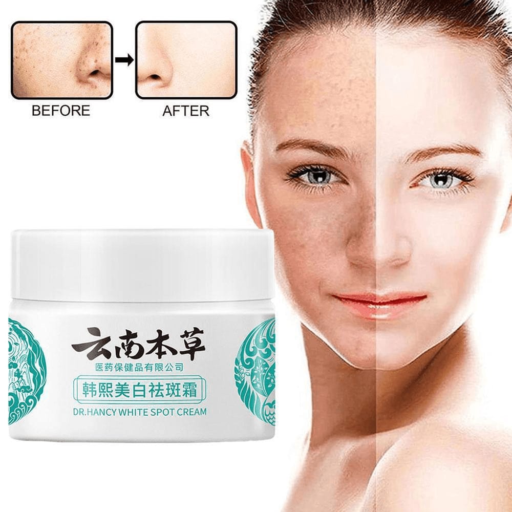 Dr. Hancy White Spot Cream тАУ 20g
