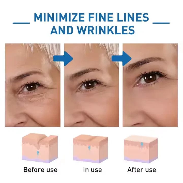 Botox Bee Venom Wrinkle Cream 20g