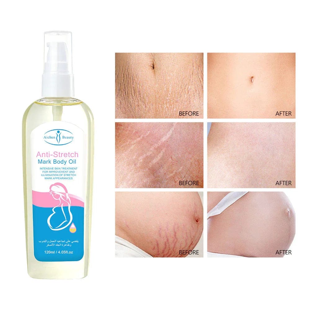 Aichun Beauty Anti-Stretch Mark Body Oil тАУ 120ml