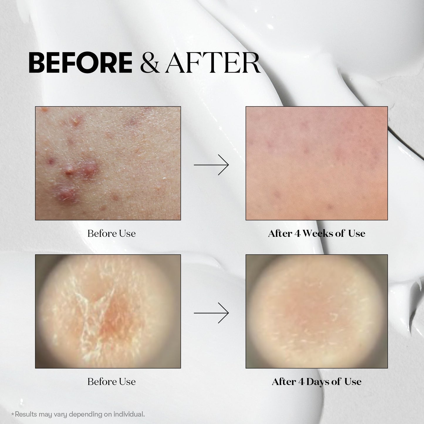 VT Cica X Hyalon Reedle Shot 100 – 50ml