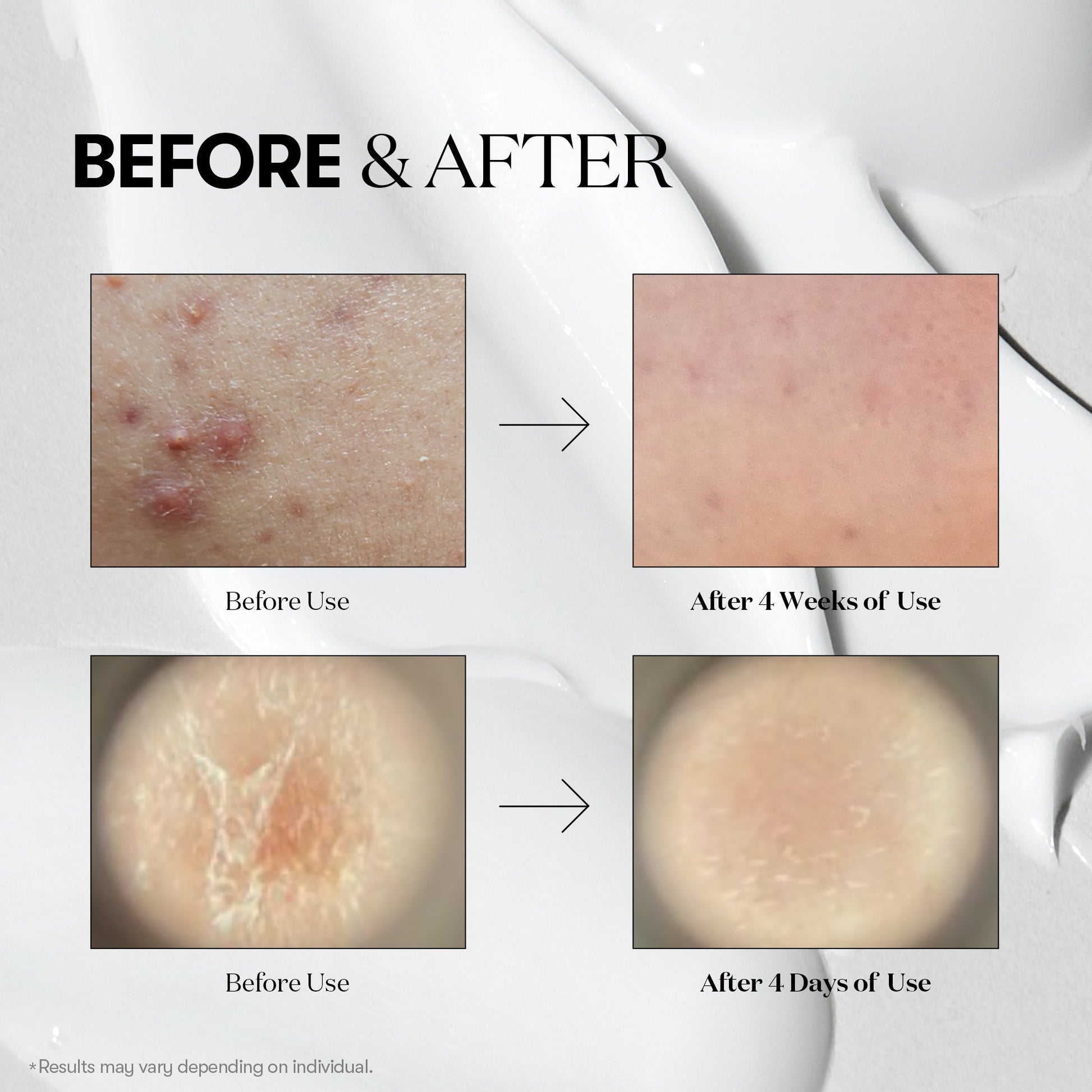 VT Cica X Hyalon Reedle Shot 100 – 50ml