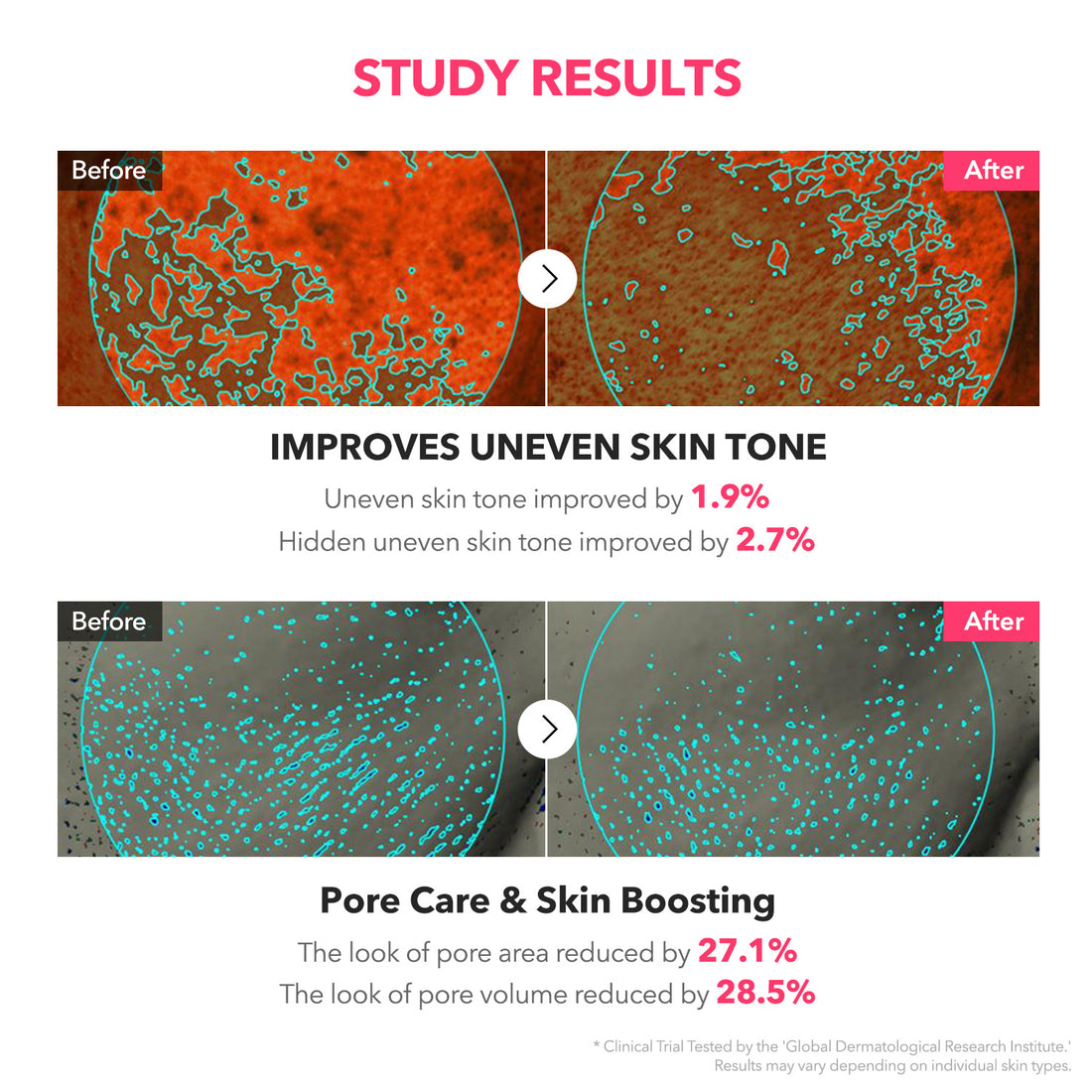 APRILSKIN TXA Niacinamide Toning Shot Serum – 30ml: Reveal Brighter, Radiant Skin