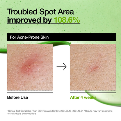 Special Bundle Anua Azelaic Acid 10+ Hyaluron Redness Soothing Serum +Dr. Althea - 345 Relief Cream