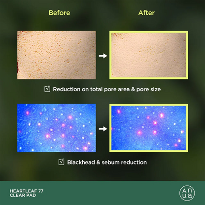 Anua Heartleaf 77% Clear Pad - 160ml