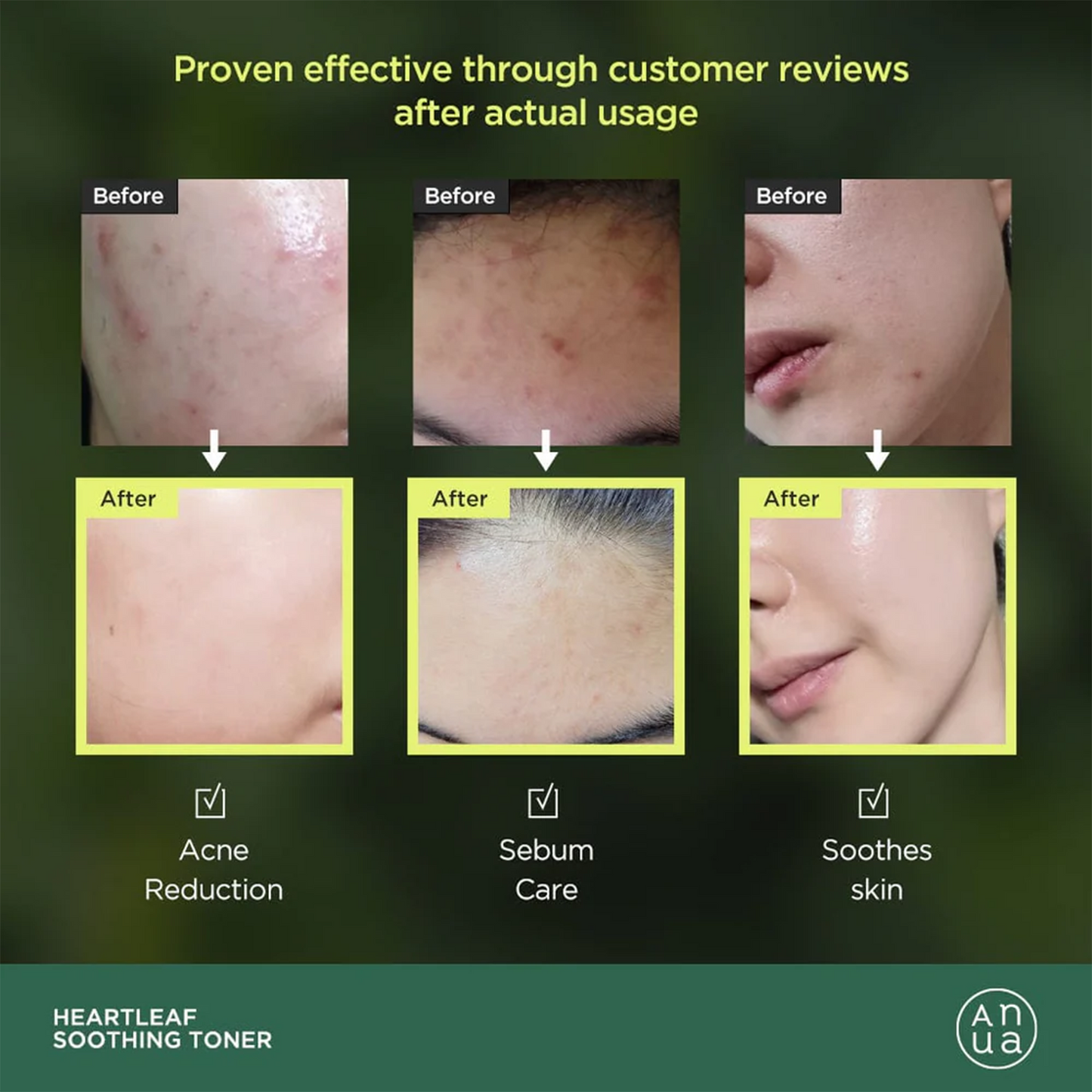 Anua Heartleaf 77% Soothing Toner - 250ml