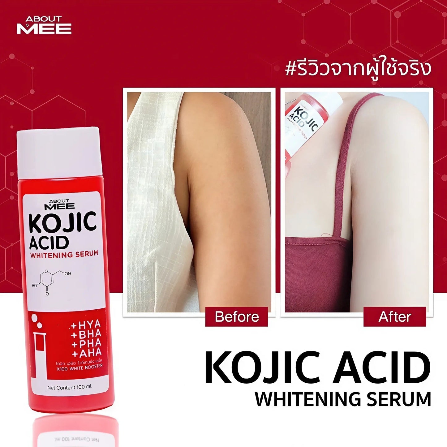 About Mee Kojic Acid Whitening Serum – 100ml