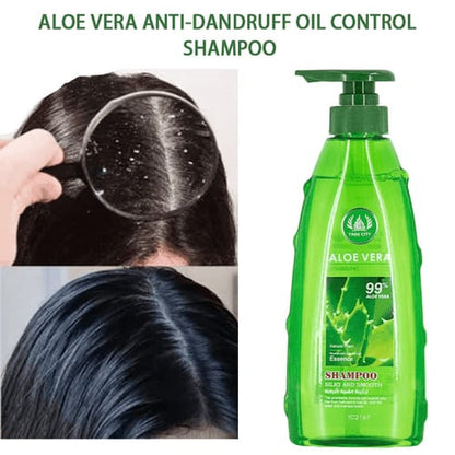 Aloe Vera Anti-Dandruff Oil Control Shampoo bottle and scalp before-after
