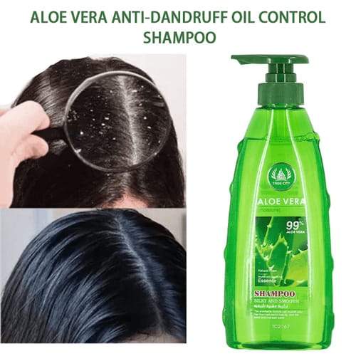 Aloe Vera Anti-Dandruff Oil Control Shampoo bottle and scalp before-after
