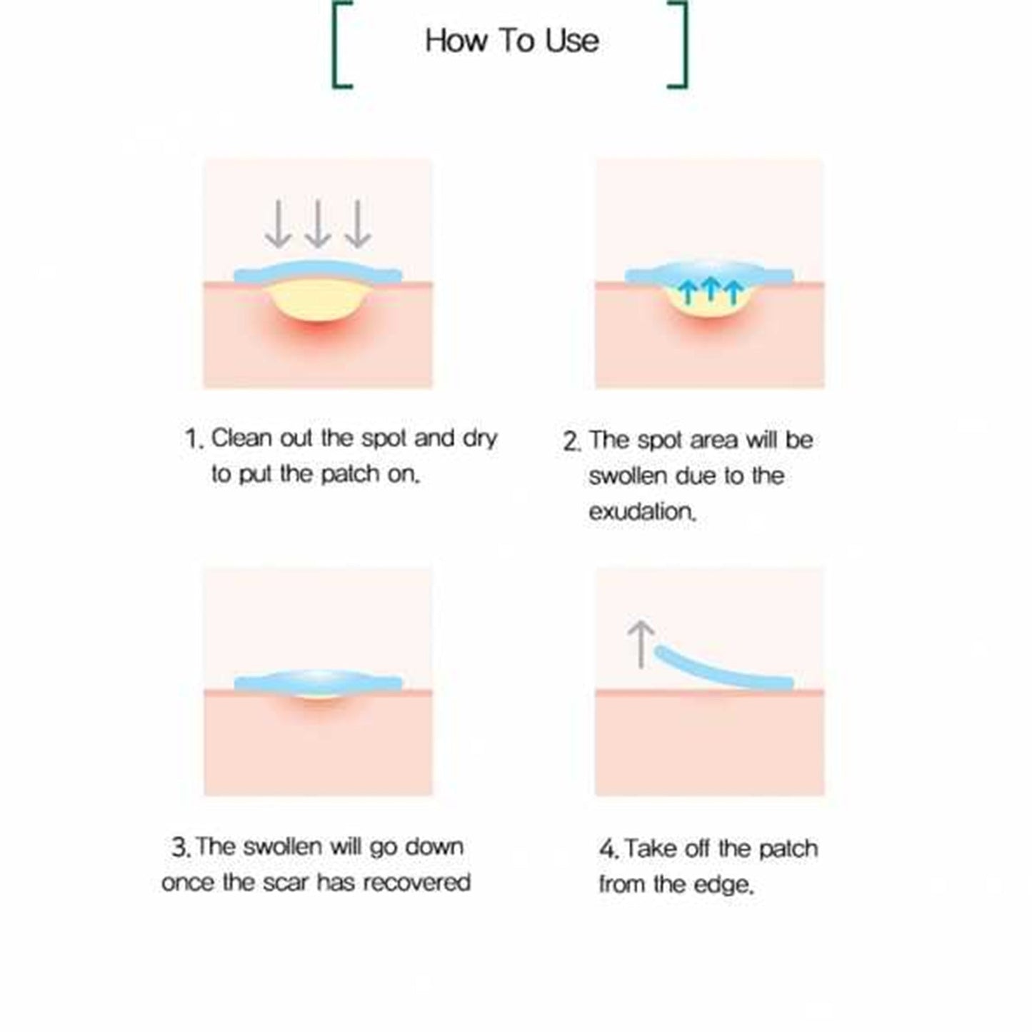 Some By Mi - Clear Spot Patch