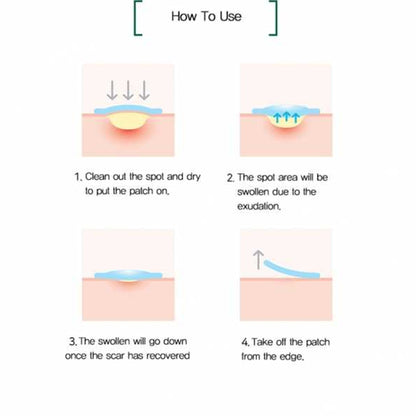 Some By Mi - Clear Spot Patch