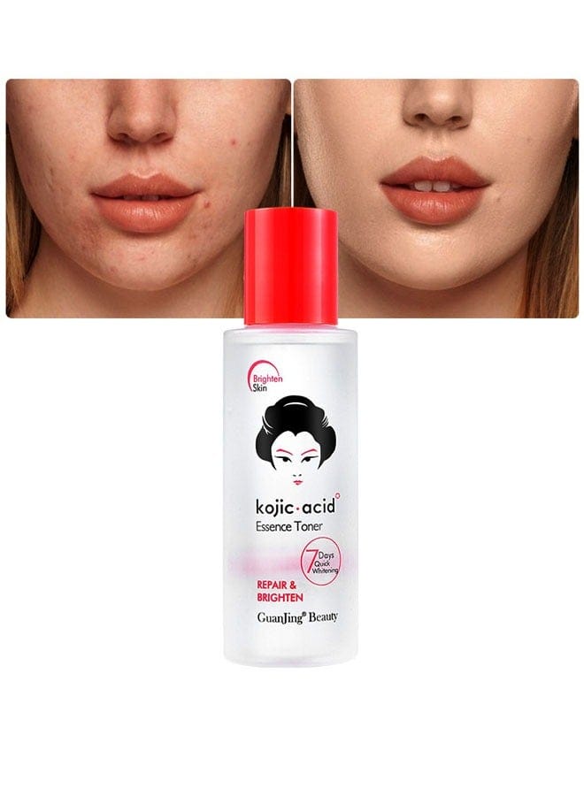 Kojic Acid Essence Toner – 100ml