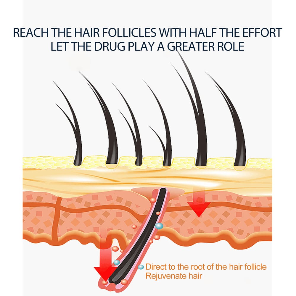 Jaysuing 5% Hair & Beard Growth Spray