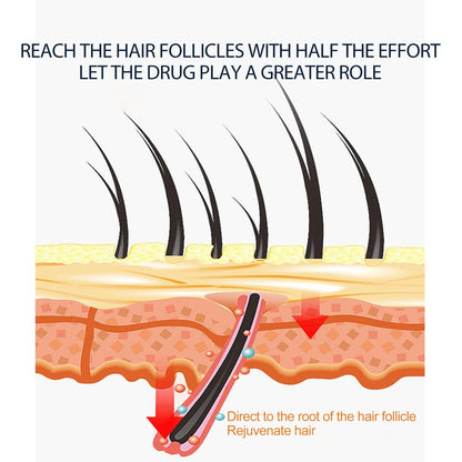 Jaysuing 5% Hair & Beard Growth Spray