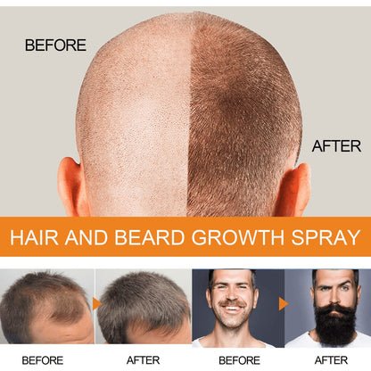 Jaysuing 5% Hair & Beard Growth Spray