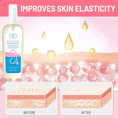 Aichun Beauty Anti-Stretch Mark Body Oil – 120ml