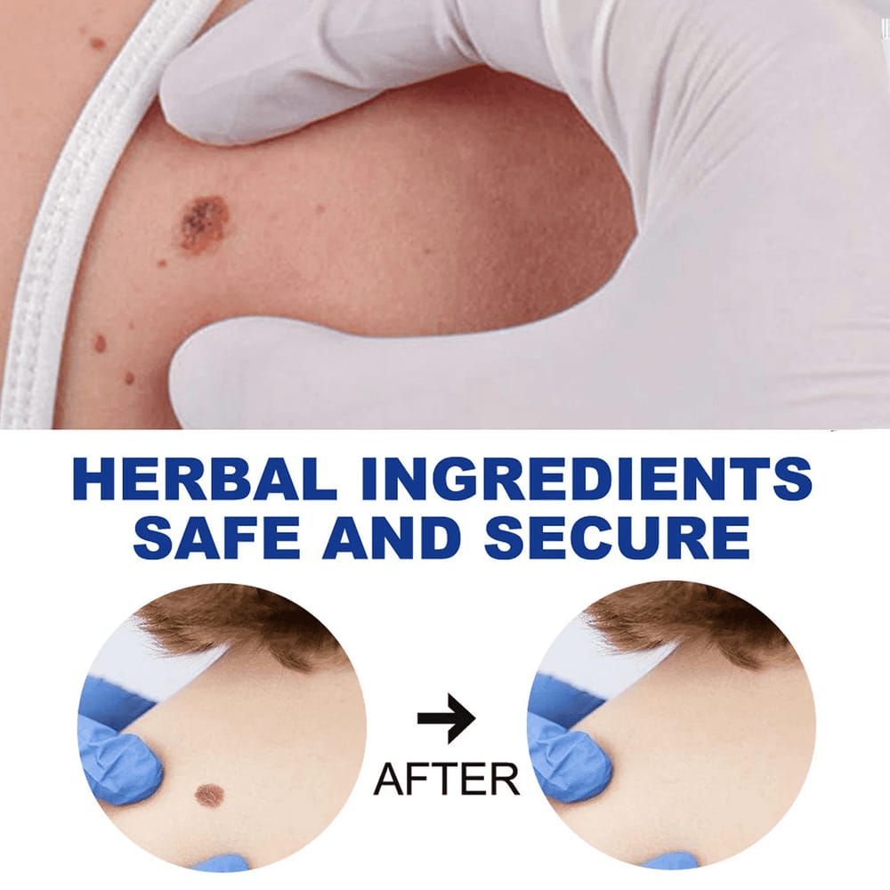 EELHOE Skin Care Herbal Ointment – Gentle Skin Soothing Cream 20g