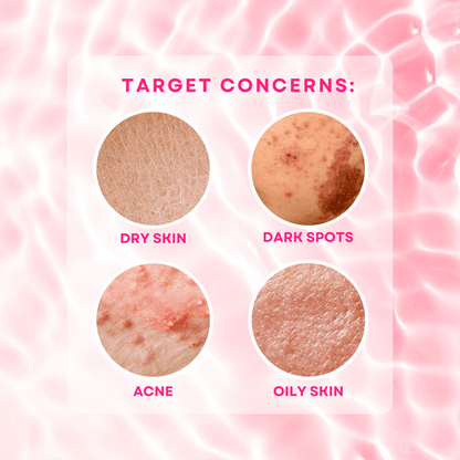 BMRS Niacinamide Soap 10x Brightening With Glutathione - 70g