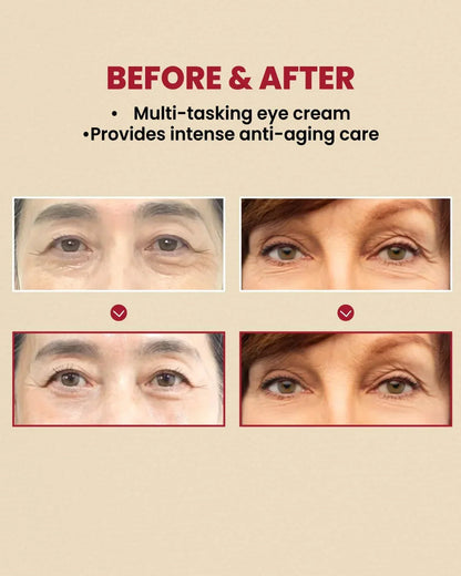 K-Secret Seoul 1988 Eye Cream Retinal Liposome 4% + Fermented Bean - 30ml