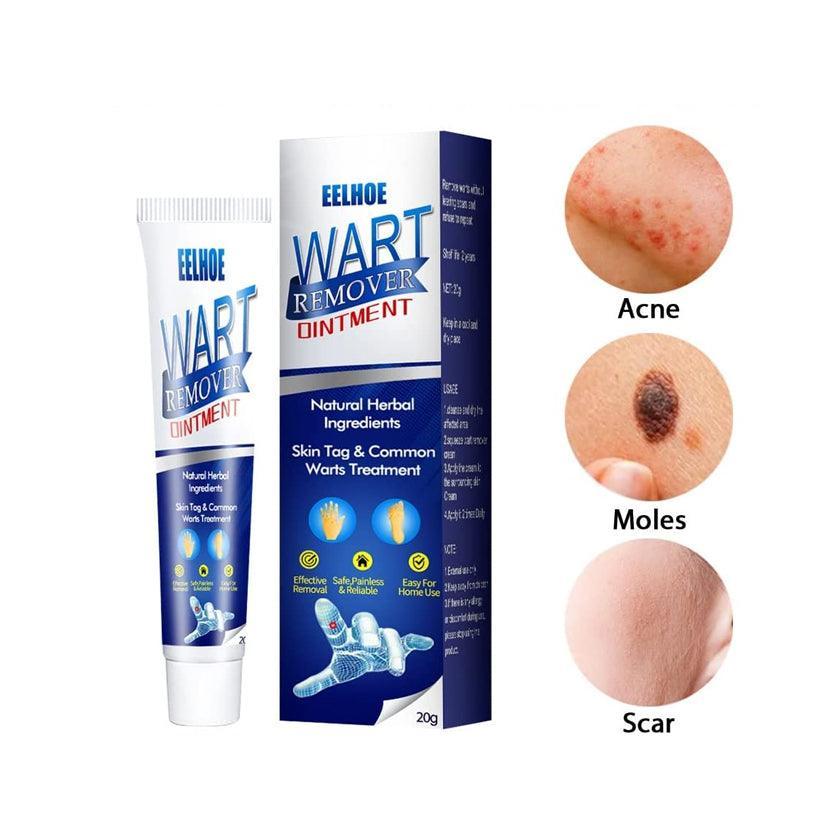 EELHOE Wart Remover Ointment - 20g